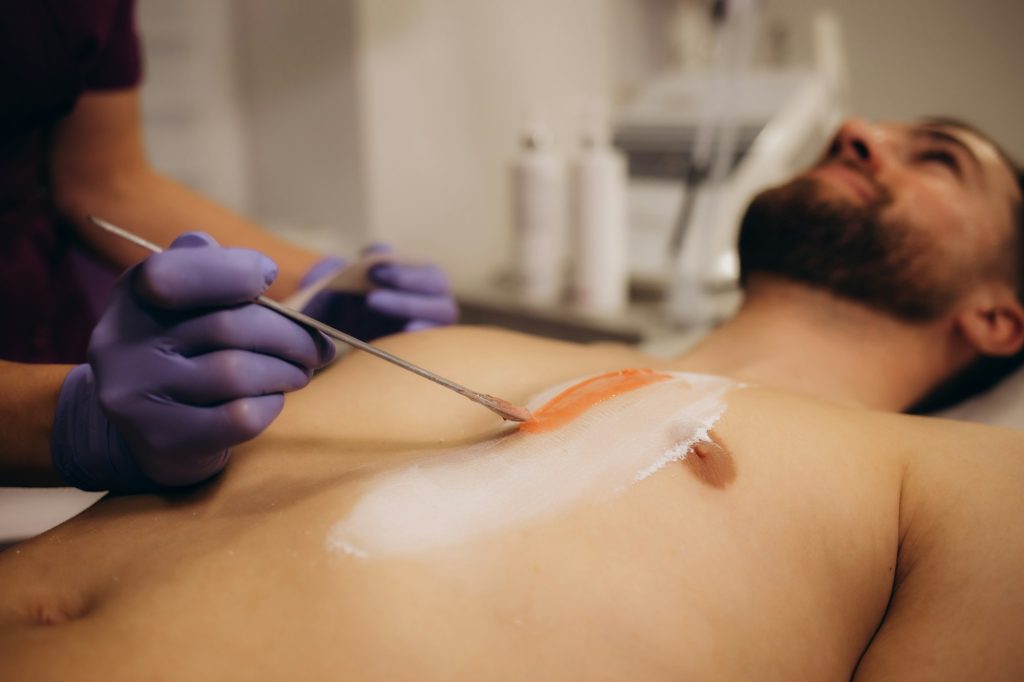 Close up of hairy chest of a man using wax epilation at home. Body Hair Removal Wax Warmer. Close up of hairy chest of a man using wax epilation at home. Body Hair Removal Wax Warmer.